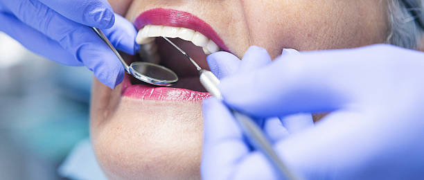 Best Emergency Wisdom Teeth Removal in Brawley, CA